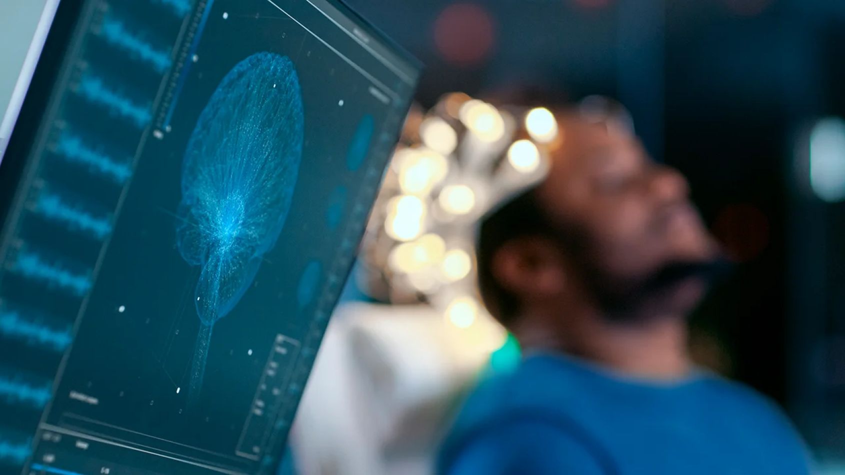El Hospital público Severo Ochoa participa en una investigación pionera sobre el diagnóstico precoz del Alzheimer